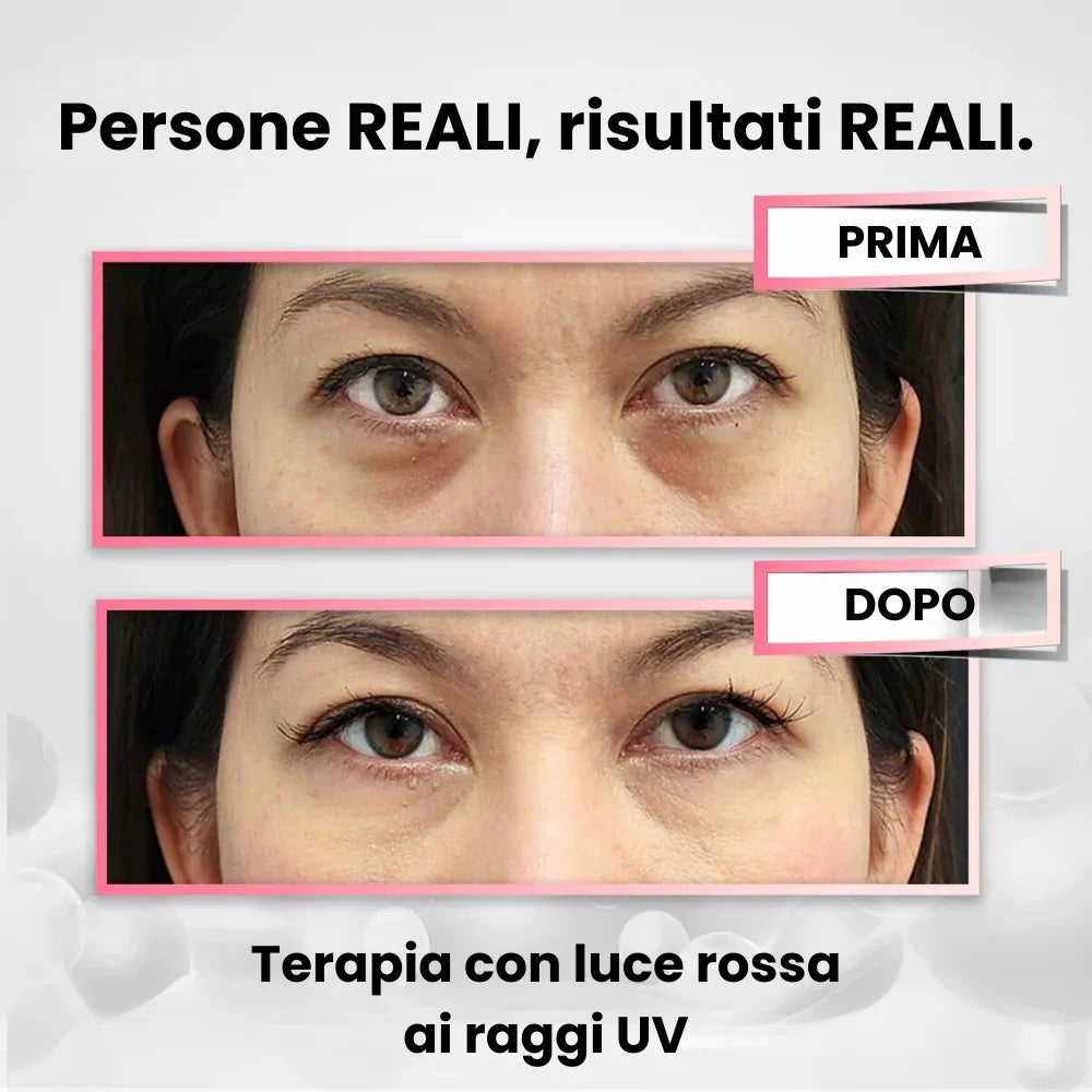 Massaggiatore Occhi Revitalizzante + Crema AntiAge in OMAGGIO